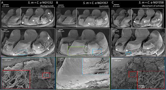 Scanning electron microscopy images of the in vivo plaque biofilms
