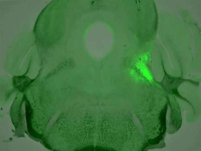 A cluster of neurons with highly active opioid receptors, highlighted in neon green, is located in a small area of the mouse brainstem.