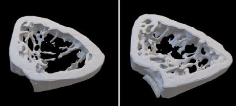 3D models of bone from mice in simulated menopause