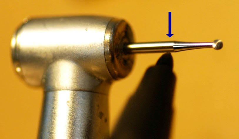  7-mm mark on a surgical length round bur